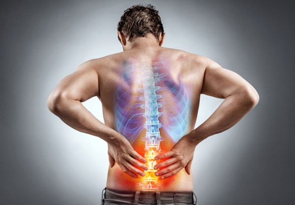 Kifoz Nedir?